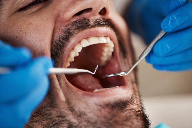 Sleep Apnea Treatment in Elma, WA